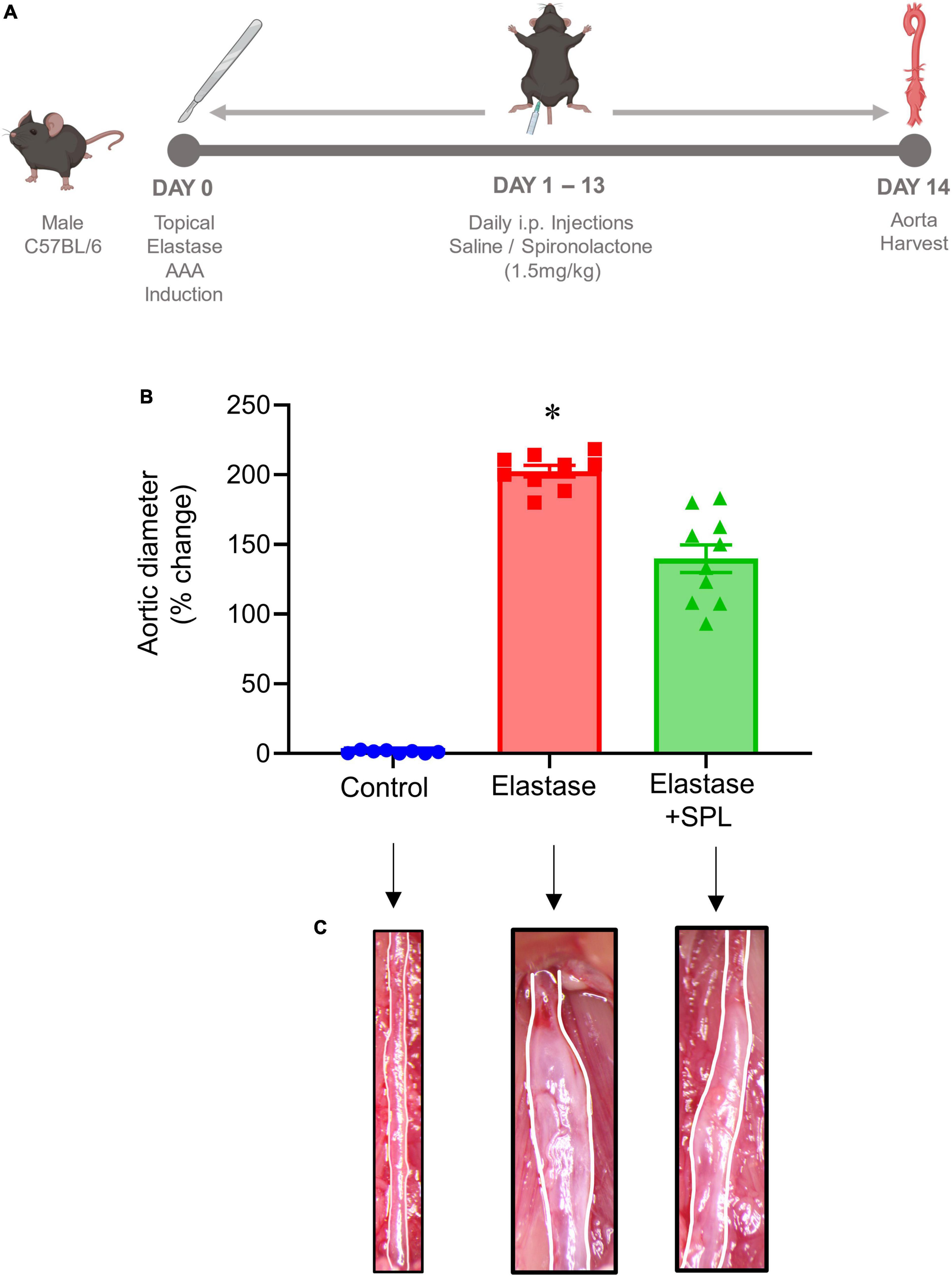 Pharmacologic inhibition by spironolactone attenuates experimental abdominal aortic aneurysms